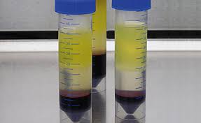 factor de transferencia
