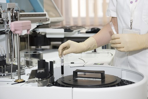 factor de transferencia post covid